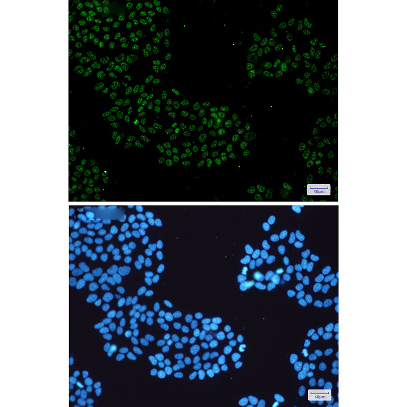 8 - KDM4B / JMJD2B Rabbit mAb AP75651