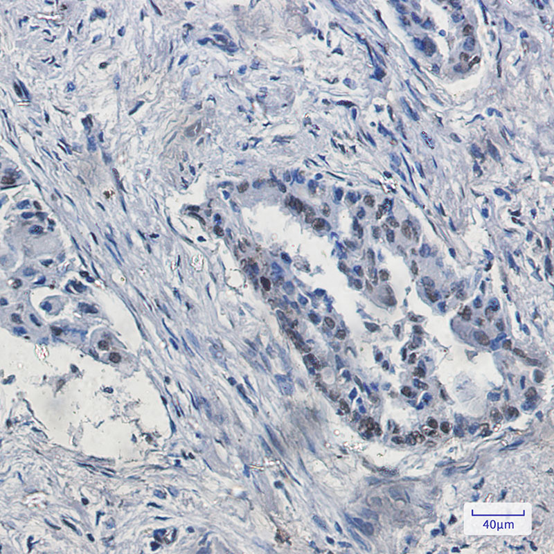 2 - KDM4B / JMJD2B Rabbit mAb AP75651