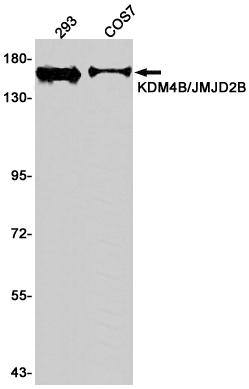 1 - KDM4B / JMJD2B Rabbit mAb AP75651