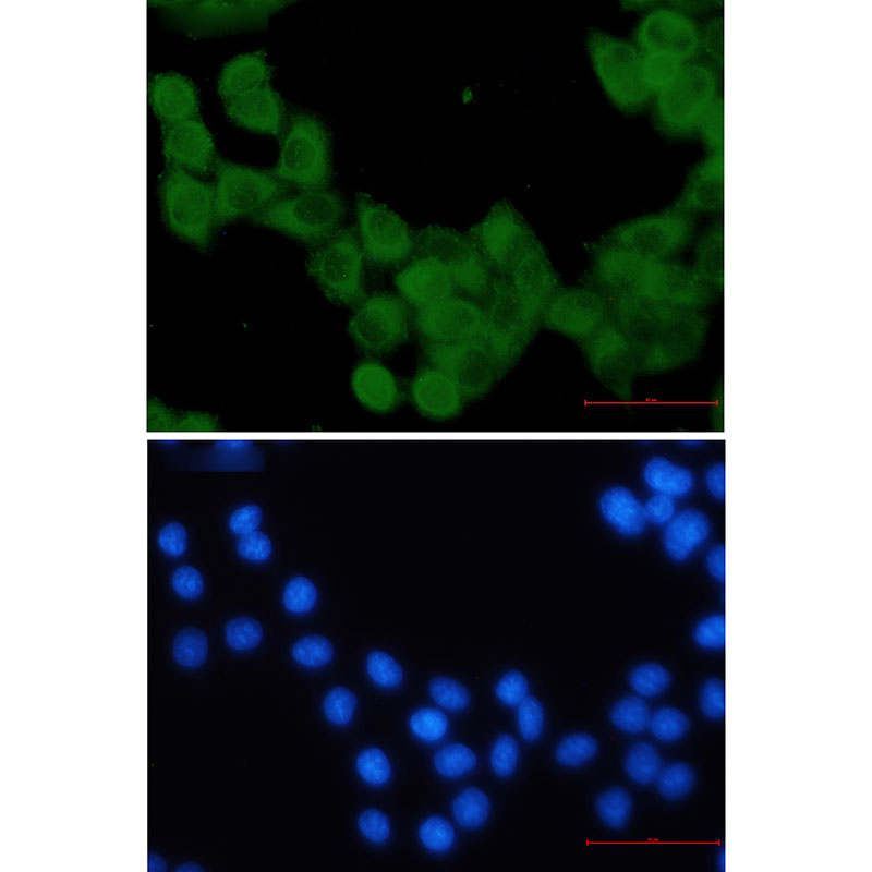 4 - KIF5B Rabbit mAb AP75653