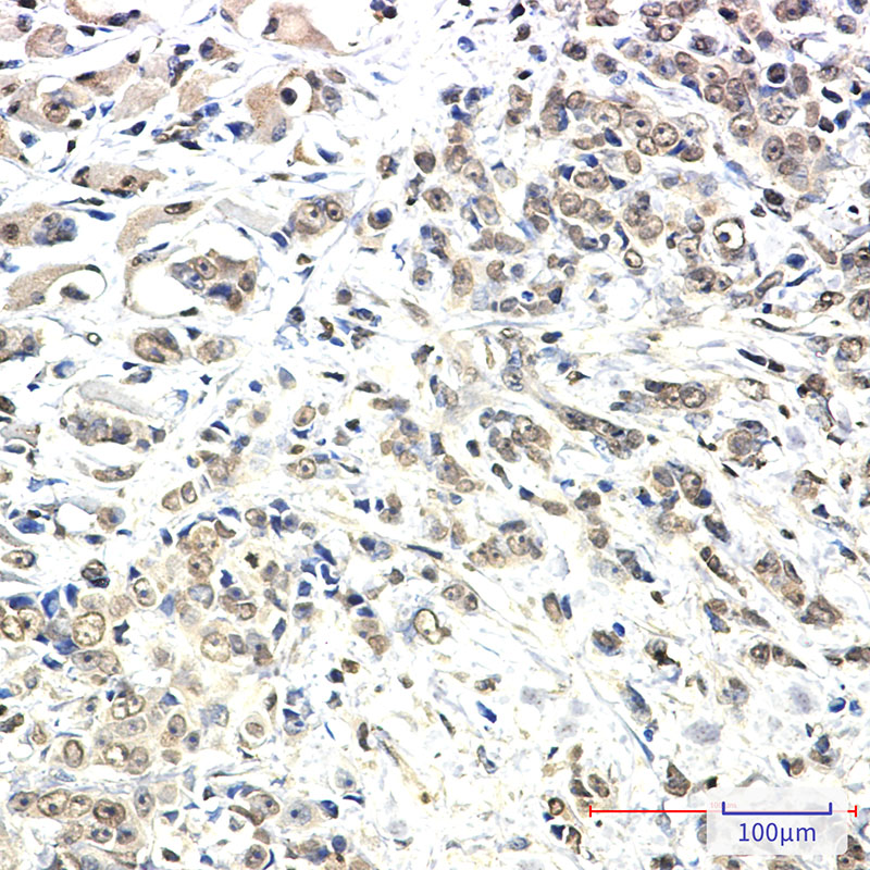 8 - KIF5B Rabbit mAb AP75653