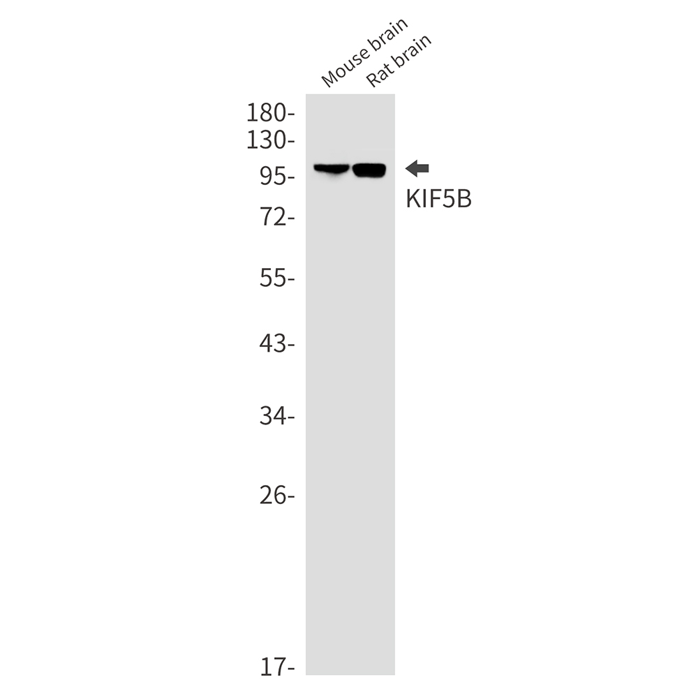1 - KIF5B Rabbit mAb AP75653