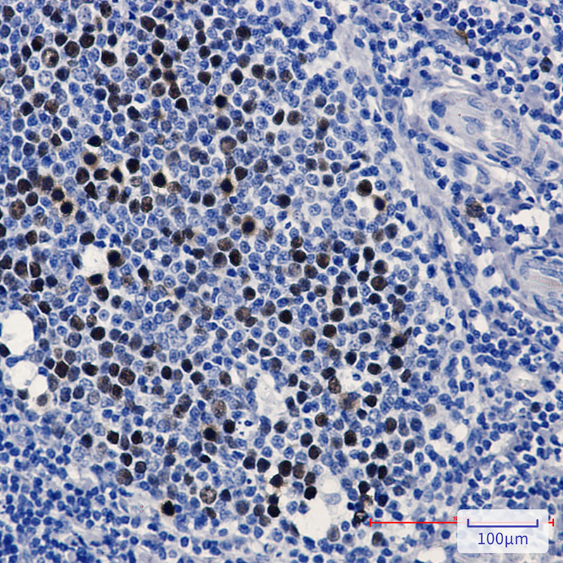 8 - KIFC1 Rabbit mAb AP75654