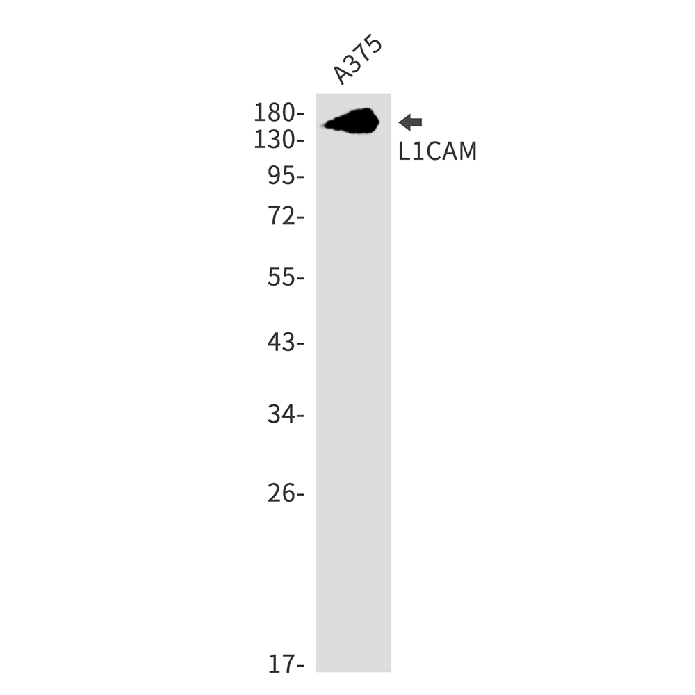 1 - L1CAM Rabbit mAb AP75658