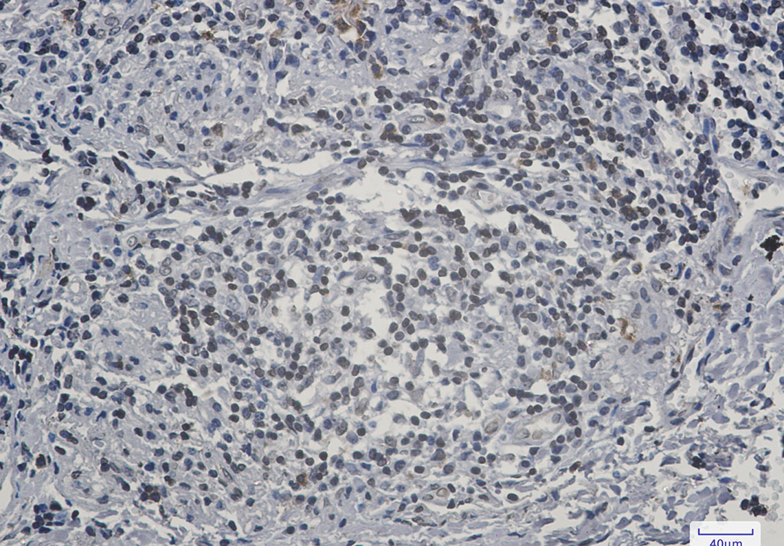 2 - Lamin B Receptor Rabbit mAb AP75661