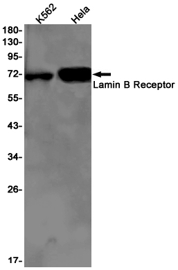 1 - Lamin B Receptor Rabbit mAb AP75661