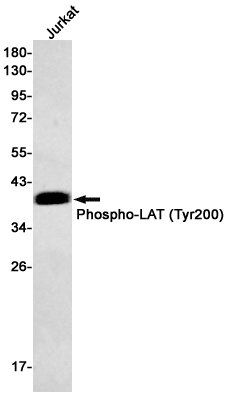 1 - Phospho-LAT (Tyr200) Rabbit mAb AP75667