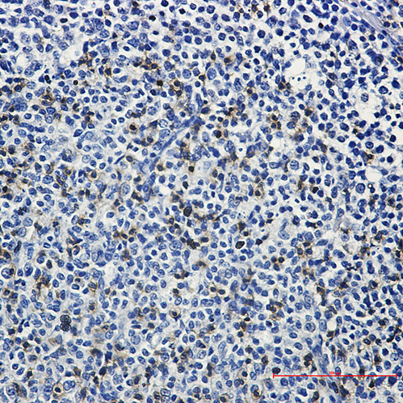 4 - [KO]LAT Rabbit mAb AP75668