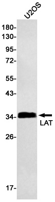 2 - [KO]LAT Rabbit mAb AP75668