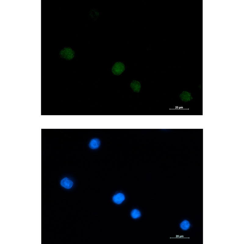 1 - LGALS14 Rabbit mAb AP75673