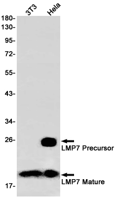 1 - PSMB8 Rabbit mAb AP75678