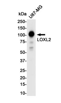 1 - LOXL2 Rabbit mAb AP75679