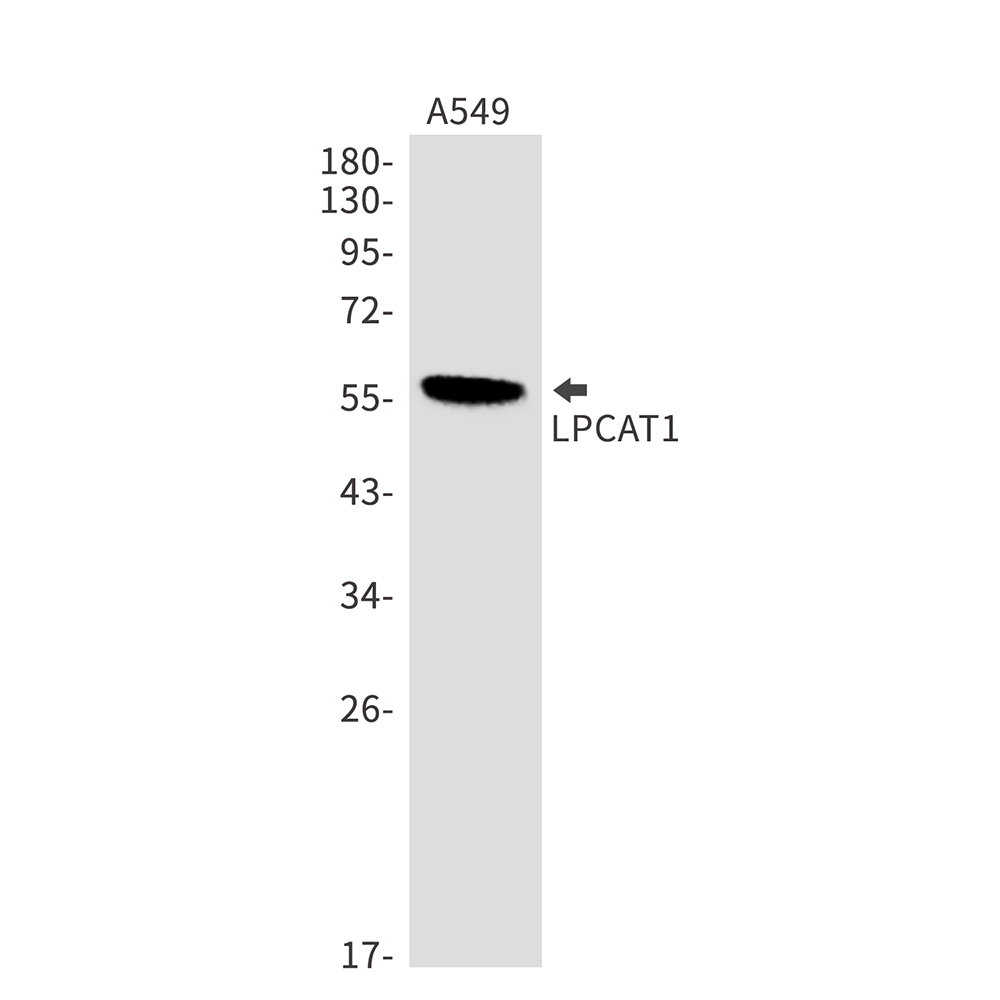 1 - [KO]LPCAT1 Rabbit mAb AP75680