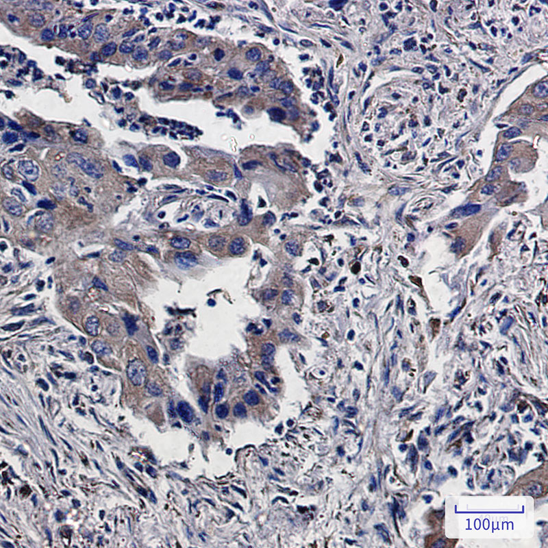 8 - Lumican Rabbit mAb AP75683