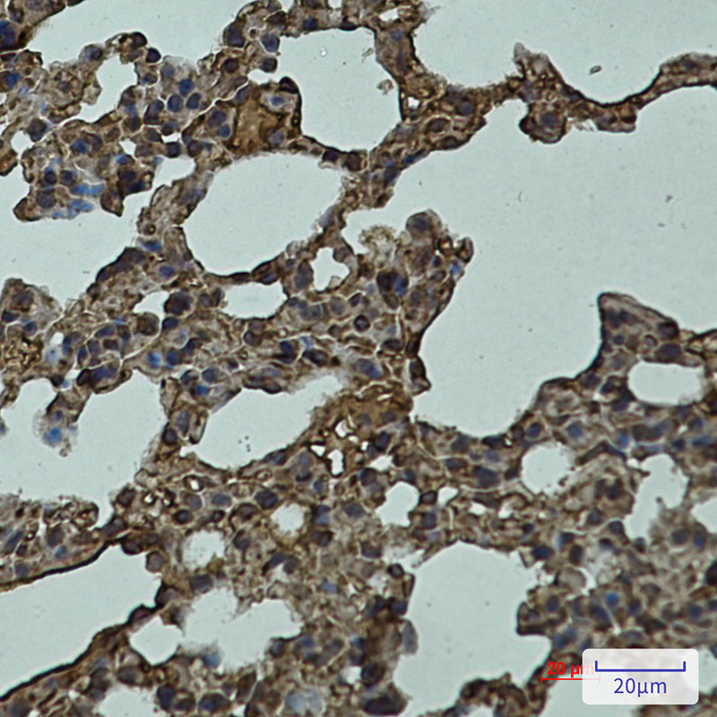 1 - LYVE1 Rabbit mAb AP75685