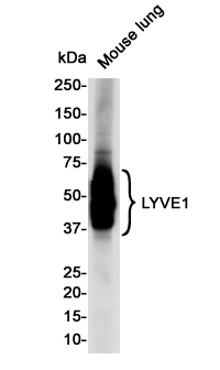 2 - LYVE1 Rabbit mAb AP75685