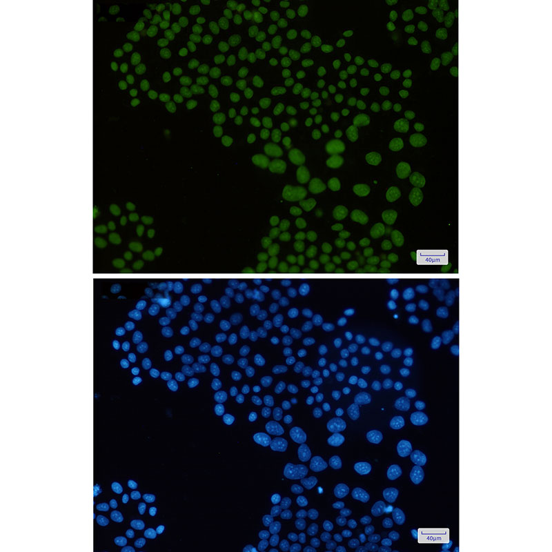 2 - mH2A1 Rabbit mAb AP75686
