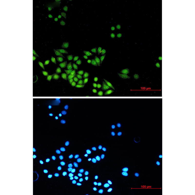 8 - [KO]MAD2L2 Rabbit mAb AP75687