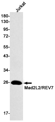 2 - [KO]MAD2L2 Rabbit mAb AP75687