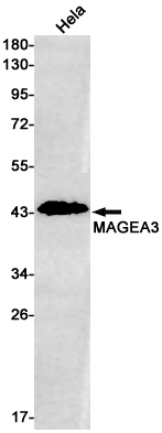 1 - MAGE3 Rabbit mAb AP75688