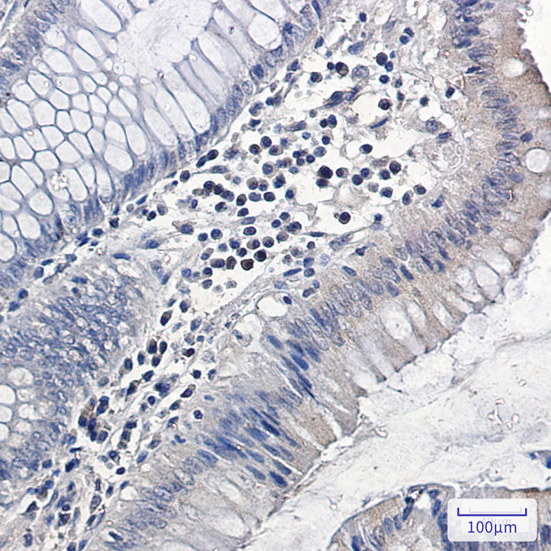 2 - MAPK6 Rabbit mAb AP75691