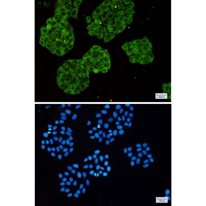 2 - [KO]MetRS Rabbit mAb AP75692