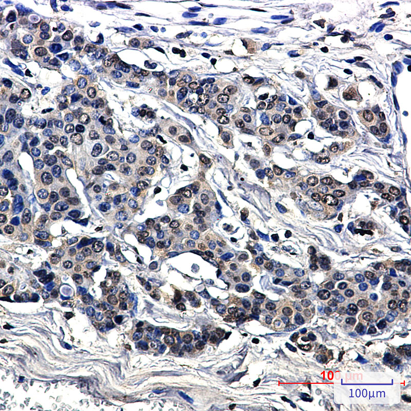 8 - [KO]MetRS Rabbit mAb AP75692