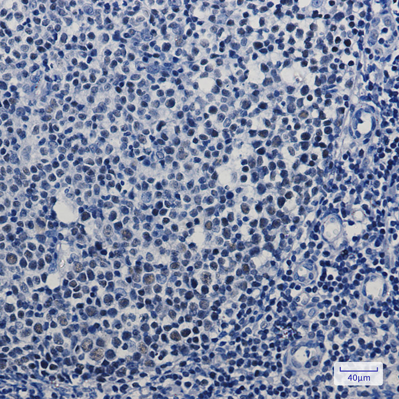 5 - [KD]MBD2 Rabbit mAb AP75695