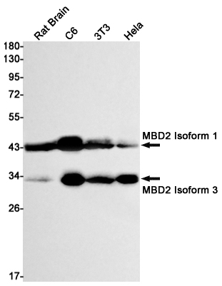4 - [KD]MBD2 Rabbit mAb AP75695