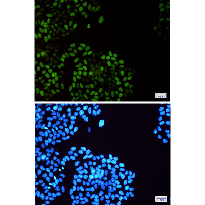 5 - Phospho-MCM2 (Ser108) Rabbit mAb AP75696