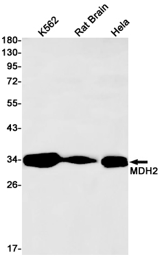 1 - MDH2 Rabbit mAb AP75702