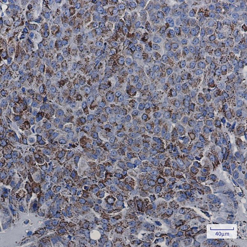 2 - MDH2 Rabbit mAb AP75703