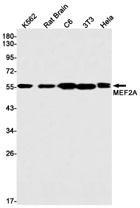 1 - MEF2A Rabbit mAb AP75705