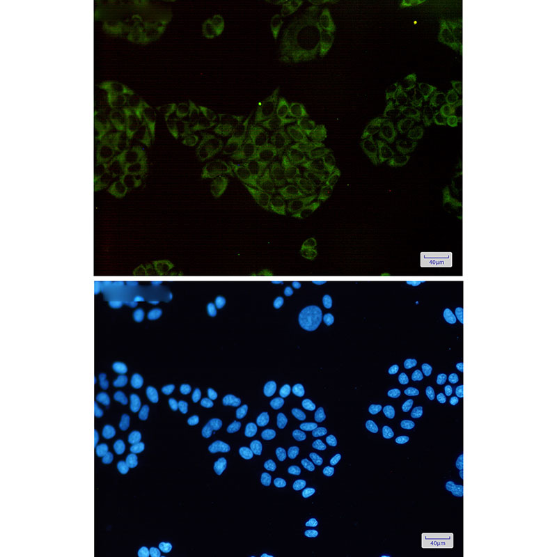 2 - MEKK2 Rabbit mAb AP75710