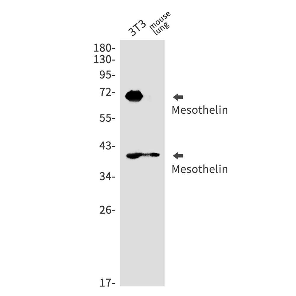 1 - Mesothelin Rabbit mAb AP75711