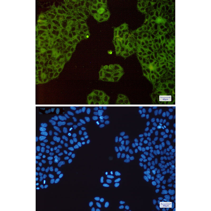 2 - c-Met Rabbit mAb AP75712