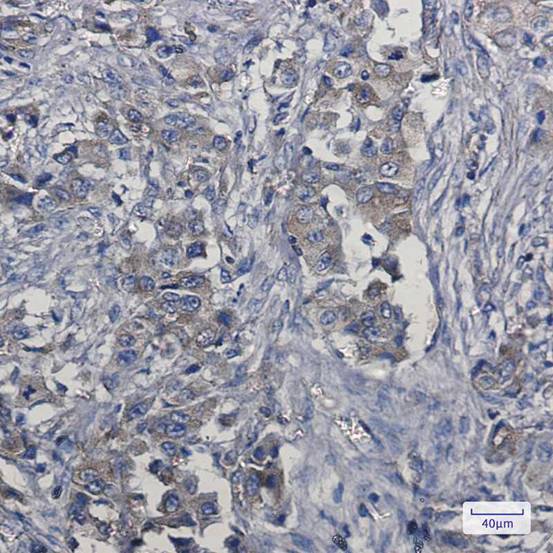 8 - c-Met Rabbit mAb AP75712