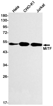 1 - MiTF Rabbit mAb AP75720