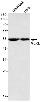8 - [KD]MLKL Rabbit mAb AP75727