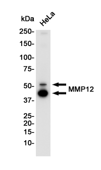 1 - MMP12 Rabbit mAb AP75728
