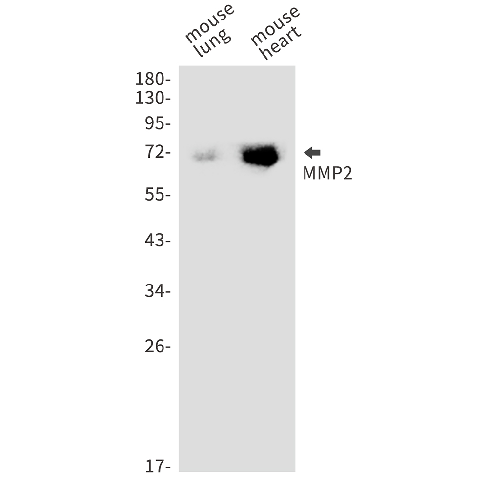 1 - MMP2 Rabbit mAb AP75729