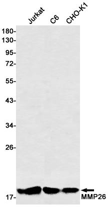 1 - MMP26 Rabbit mAb AP75730