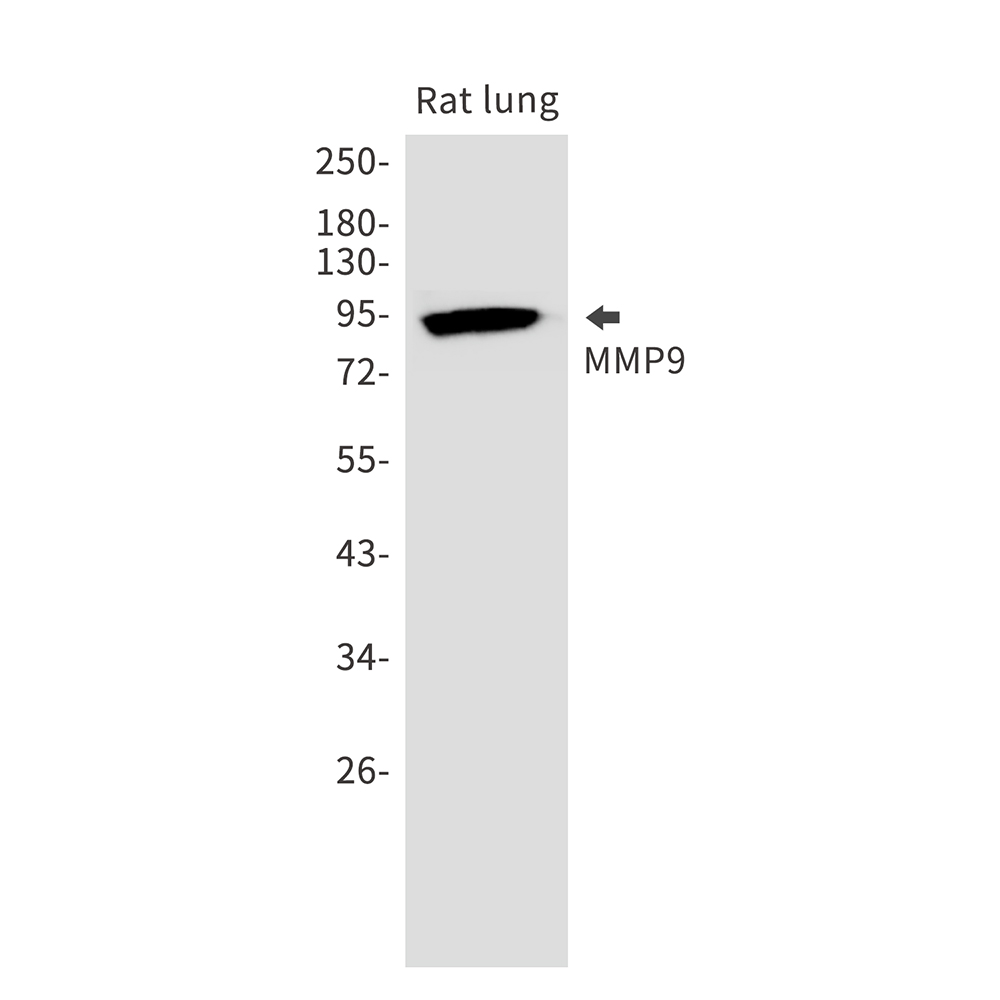 1 - MMP9 Rabbit mAb AP75732