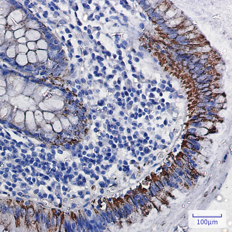 2 - Monoamine Oxidase A Rabbit mAb AP75734