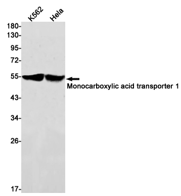 1 - Monocarboxylic Acid Transporter 1 Rabbit mAb AP75735