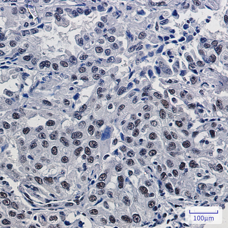 2 - Mre11 Rabbit mAb AP75736