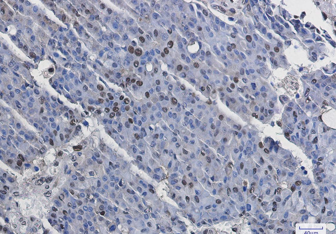 8 - Phospho-MSK1 (Ser376) Rabbit mAb AP75742
