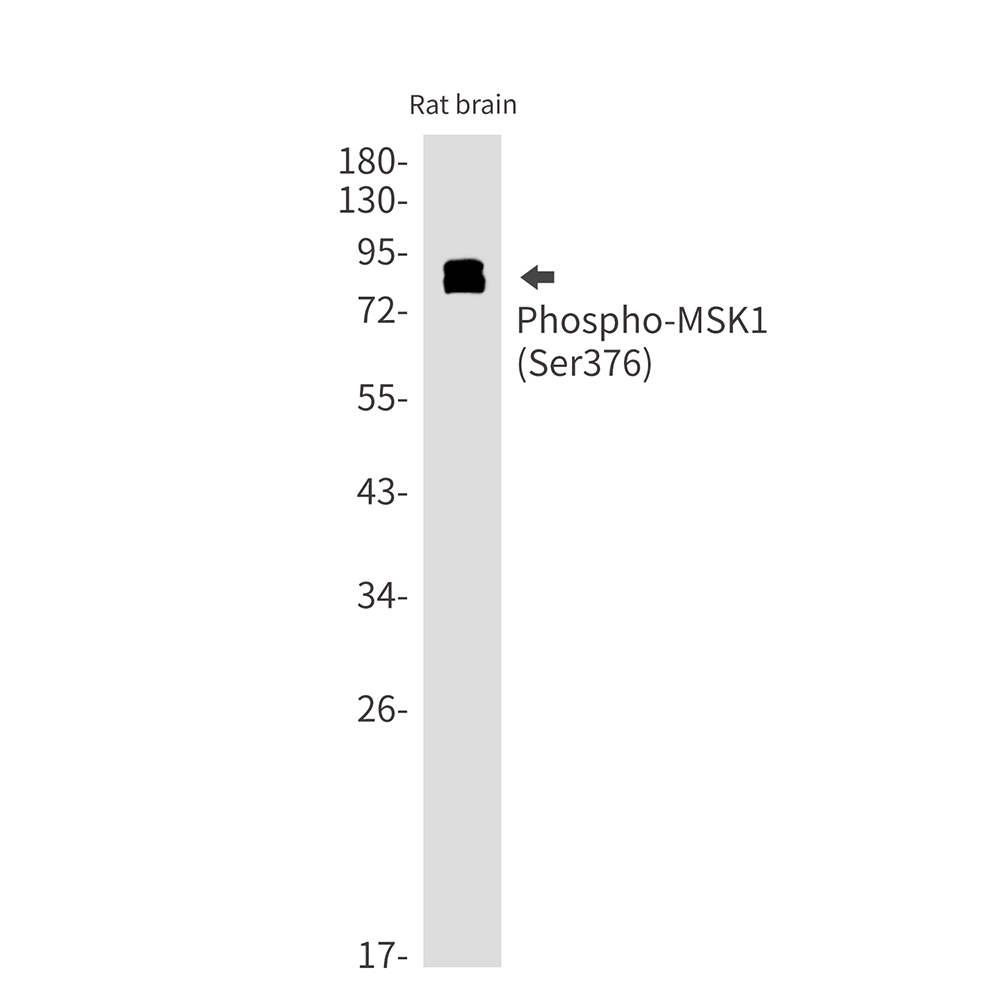 1 - Phospho-MSK1 (Ser376) Rabbit mAb AP75742