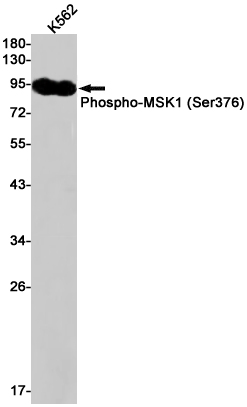 2 - Phospho-MSK1 (Ser376) Rabbit mAb AP75742