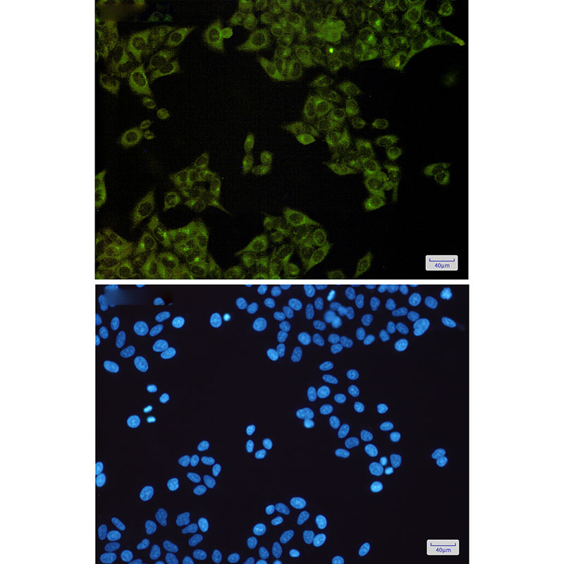 2 - MST4 Rabbit mAb AP75744